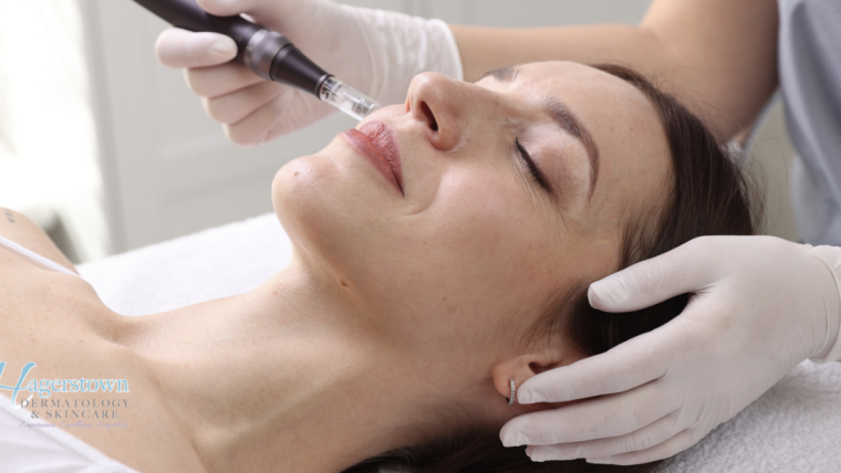 Cosmetic Dermatology Consultation Near McLean, Virginia